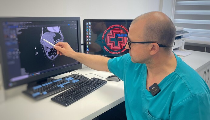 У Львові лікарі виростили частину печінки в організмі немовляти