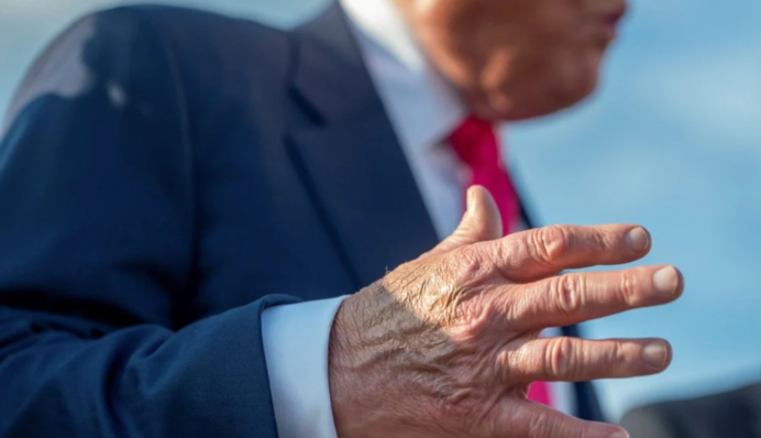 Белый дом объяснил синяки на руке Трампа