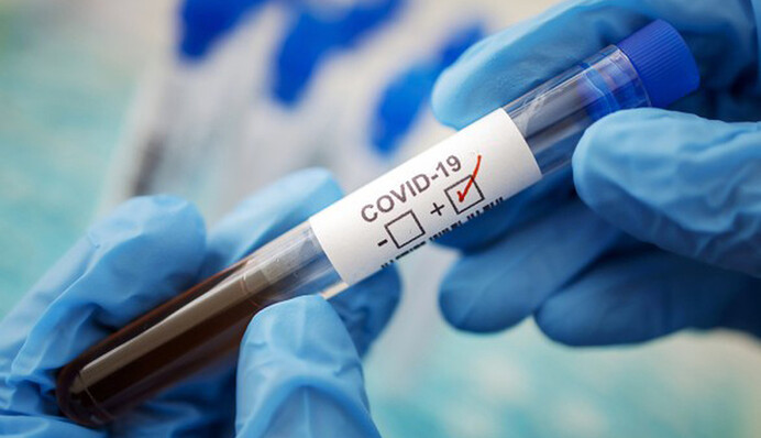 Летняя вспышка COVID-19 в Украине: насколько опасны новые штаммы и что делать, чтобы не заболеть