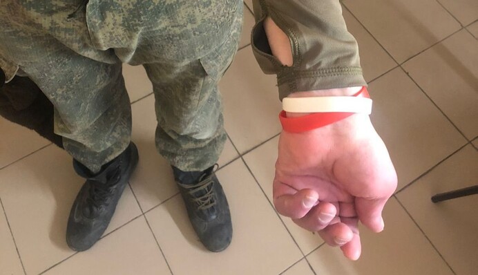 ВІЛ та гепатит у російській армії: аналітикиня розповіла про причини епідемій