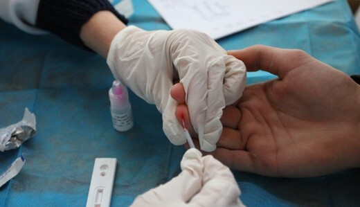 СПИДу назначили терапию