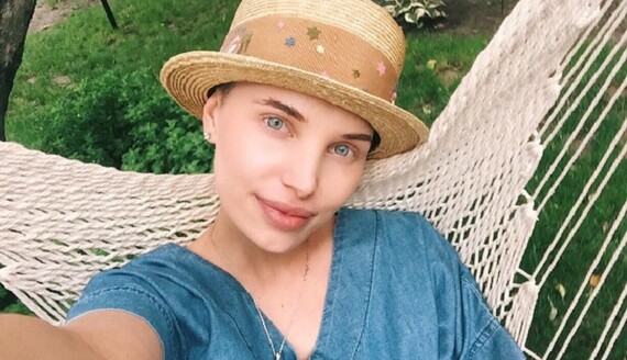 Рак-дурак: онкобольная украинская модель вызвала восторг у звезд эстрады своим позитивом