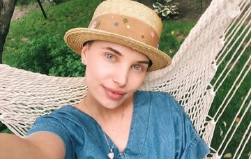 Рак-дурак: онкобольная украинская модель вызвала восторг у звезд эстрады своим позитивом