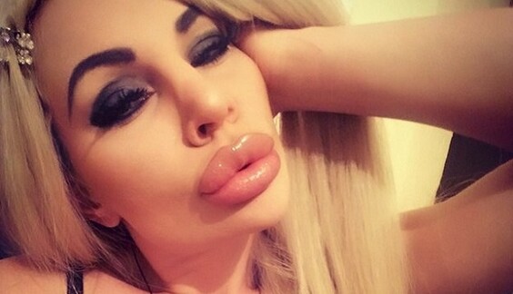 От российской модели после пластики ягодиц сбежал жених