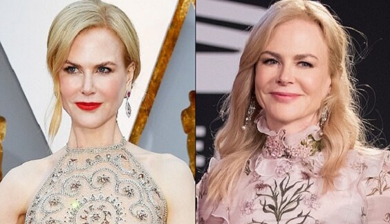 Пластический хирург объяснил, почему у Николь Кидман 