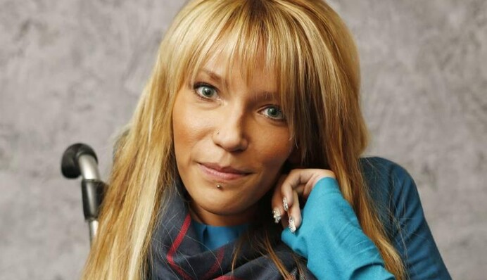 Юлия Самойлова призналась, что посещает пластического хирурга