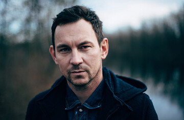 Известного украинского музыканта покусала собака: опубликованы фото