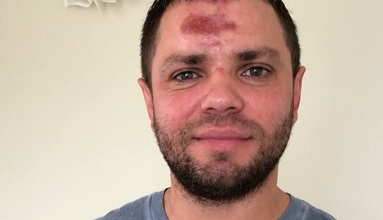 Пострадавший в ДТП российский музыкант опубликовал видео травм