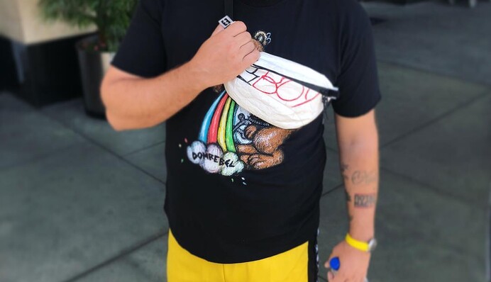 Моя психика разрушена: Потап шокировал поклонников изменениями во внешности