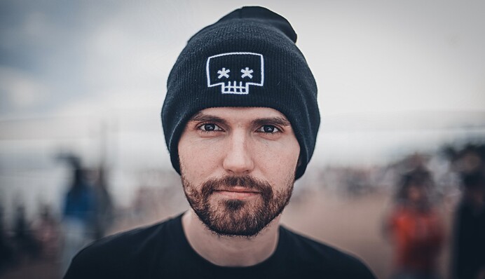 Знаменитый российский музыкант разбил голову фанату во время концерта