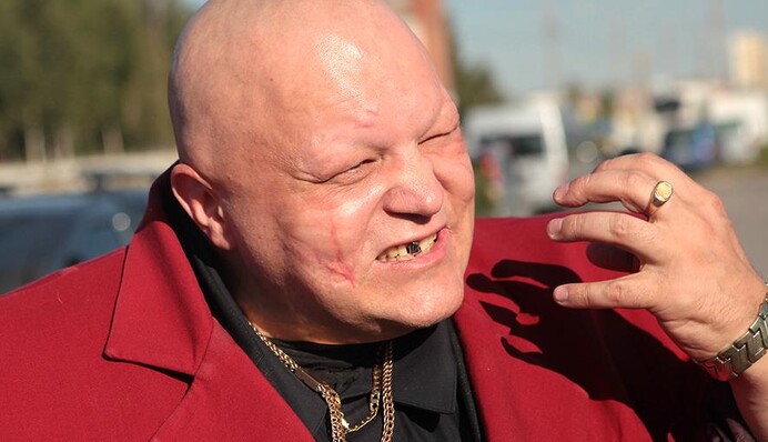 Скандальный российский певец попал в серьезное ДТП с трактором: фото и видео с места аварии