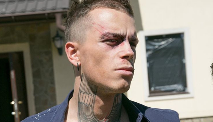 Опять драка: фанатов шокировало фото окровавленного участника 