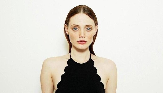 Избил муж: известная модель показала травмы