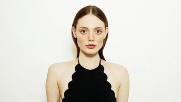 Избил муж: известная модель показала травмы