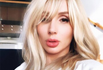 Лободе до конца жизни придется соблюдать строгую диету