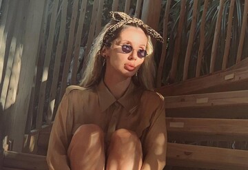 Как такое возможно? Лобода напугала поклонников синяками и ссадинами