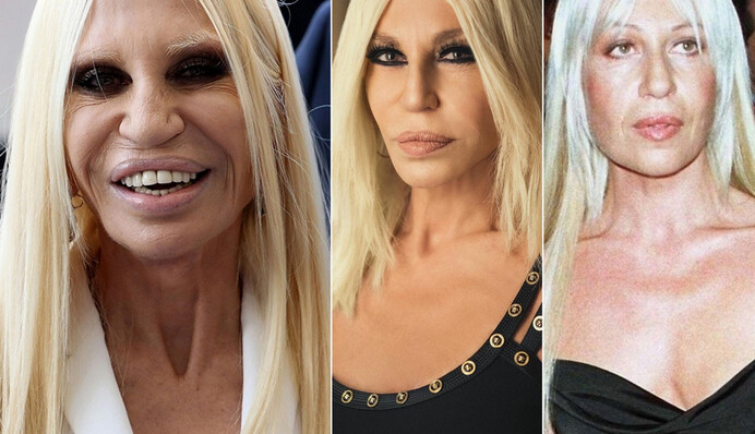 Донателле Версаче - 65: как изменилась самая известная жертва пластических операций