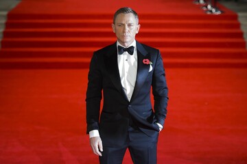 Звезду бондианы Дэниела Крэйга прооперируют: что известно