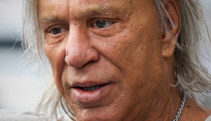 Всесвітньо відомий актор так захопився пластикою, що його не впізнали в ефірі ранкового шоу: фото