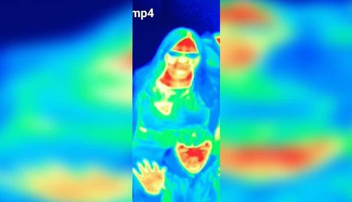 Женщина обнаружила у себя рак груди благодаря экспонату в музее