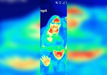 Жінка виявила у себе рак грудей завдяки експонату в музеї