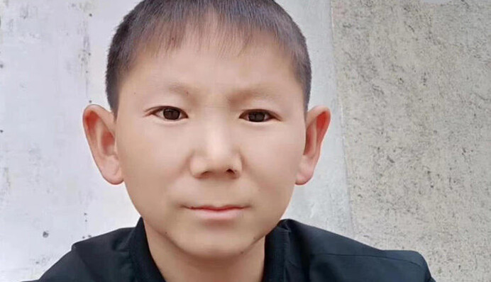 Чоловіка в дитинстві вдарили по голові і він перестав дорослішати: сьогодні йому 34, але в це важко повірити