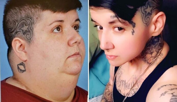 Жінка скинула 225 кг після видалення язика