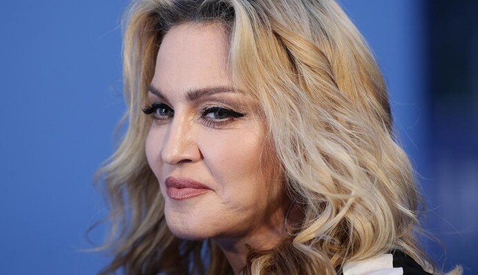 Невимовний біль: 61-річна Мадонна розповіла про проблеми зі здоров'ям після скасування концерту