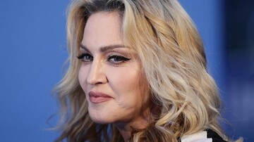 Невимовний біль: 61-річна Мадонна розповіла про проблеми зі здоров'ям після скасування концерту