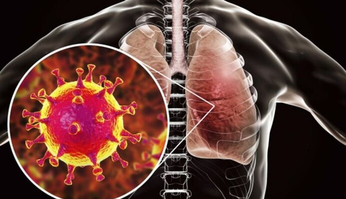 Новый смертельный вирус из Китая: как уберечься от болезни