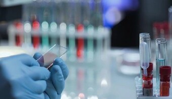 Більше мільйона людей заразилися коронавірусом: що відбувається в Україні і світі (хроніка 5 квітня)