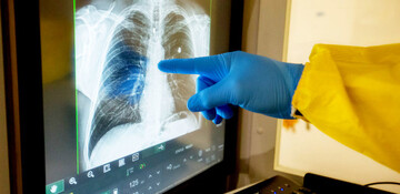 Антирекорд США і Зеленський в госпіталі: все про пандемію коронавірусу (хроніка 11 квітня)