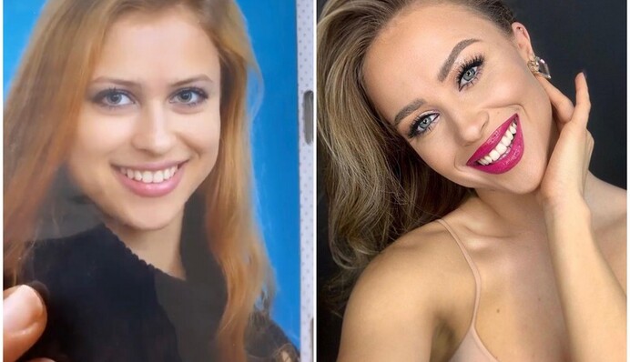 Украинская модель показала забавные детские фото - теперь в натуральности ее губ сомнений нет