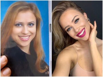 Українська модель показала забавні дитячі фото - тепер у натуральності її губ сумнівів немає