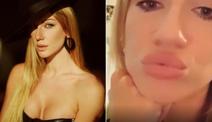 Леся Нікітюк відповіла на чутки про збільшені губи і ботокс