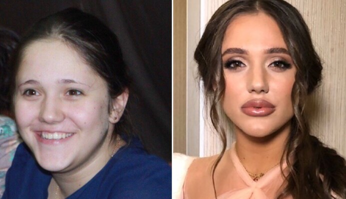 Учасниця шоу Холостяк-10 показала фото до схуднення, і їй не повірили. Адже це дві різні людини