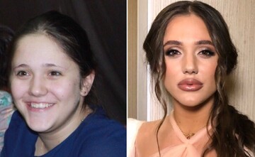 Учасниця шоу Холостяк-10 показала фото до схуднення, і їй не повірили. Адже це дві різні людини