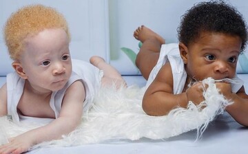 Дівчина народила близнюків з різним кольором шкіри. Тепер їй не вірять, що обидві дитини її