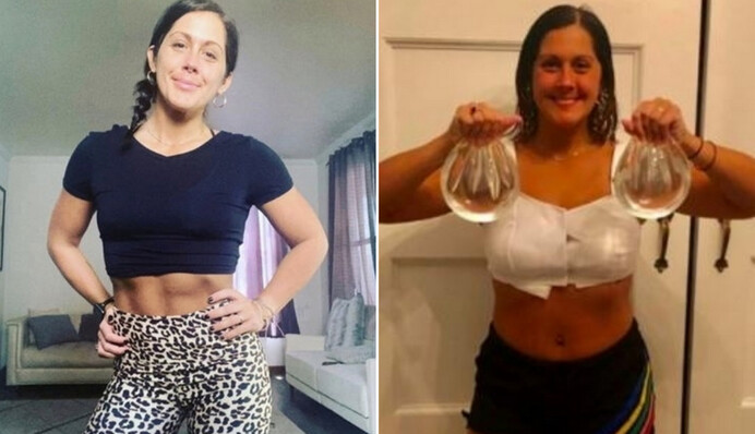 Женщина вдруг стала терять память и врачи развели руками. Кто бы мог подумать, что дело в имплантах груди