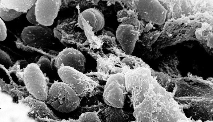 Чи загрожує бубонна чума та свинячий грип Україні: бліц з епідеміологом