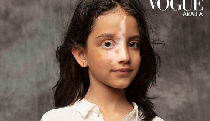 Пострадавшая от взрыва в Бейруте девочка появилась на обложке Vogue