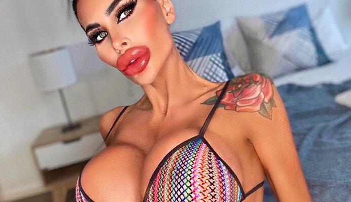 Дівчина так захопилася пластикою, що стала схожа на ляльку. Лікарі просять зупинитися