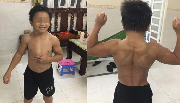 10-летний мальчик поражает мускулистым телом, но это не связано с физическими упражнениями