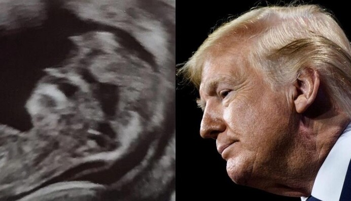 Малюк шокував батьків ще до появи на світ - він виявився 