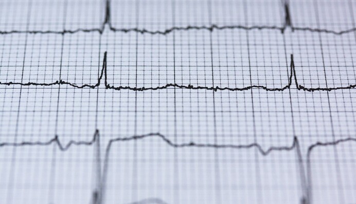 Що буде, якщо проковтнути батарейку? Хитрий в'язень провів експеримент і здивував лікарів