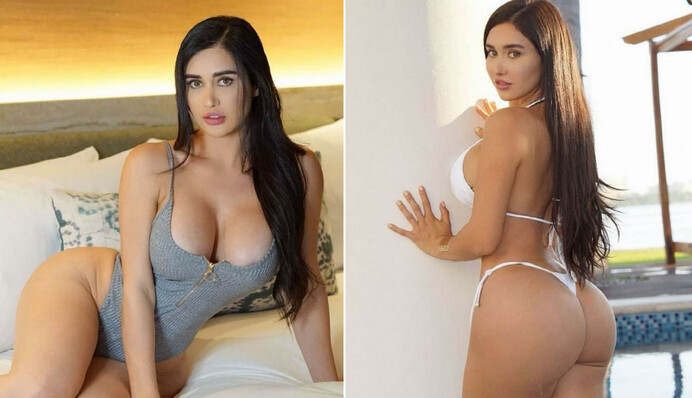 Подражательница Ким Кардашьян из Мексики умерла после неудачной операции на ягодицах