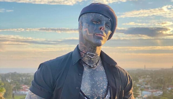 Мужчина удалил нос и губу, чтобы стать похожим на инопланетянина - теперь он хочет заменить кожу металлом