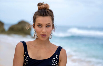 У Регіни Тодоренко знайшли невиліковну хворобу Майкла Джексона