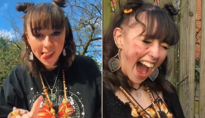 Девушка с синдромом Туретта показывает в TikTok, как проявляется болезнь, и от ее видео становится не по себе