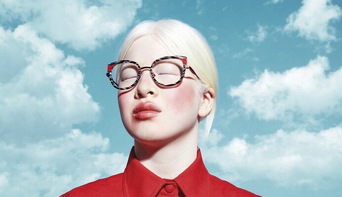 Родители бросили дочь с альбинизмом из-за 